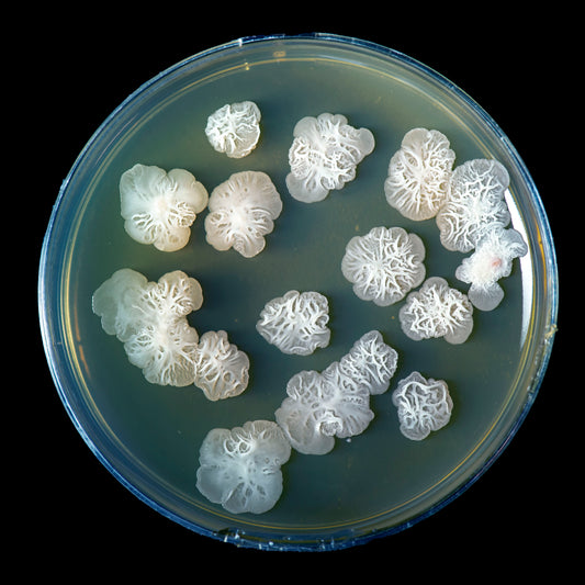 5 Fermented Food Facts That Help Health